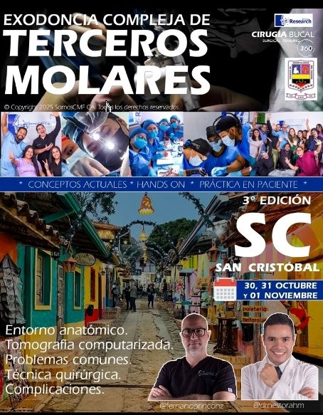 Exodoncia Compleja de Terceros Molares