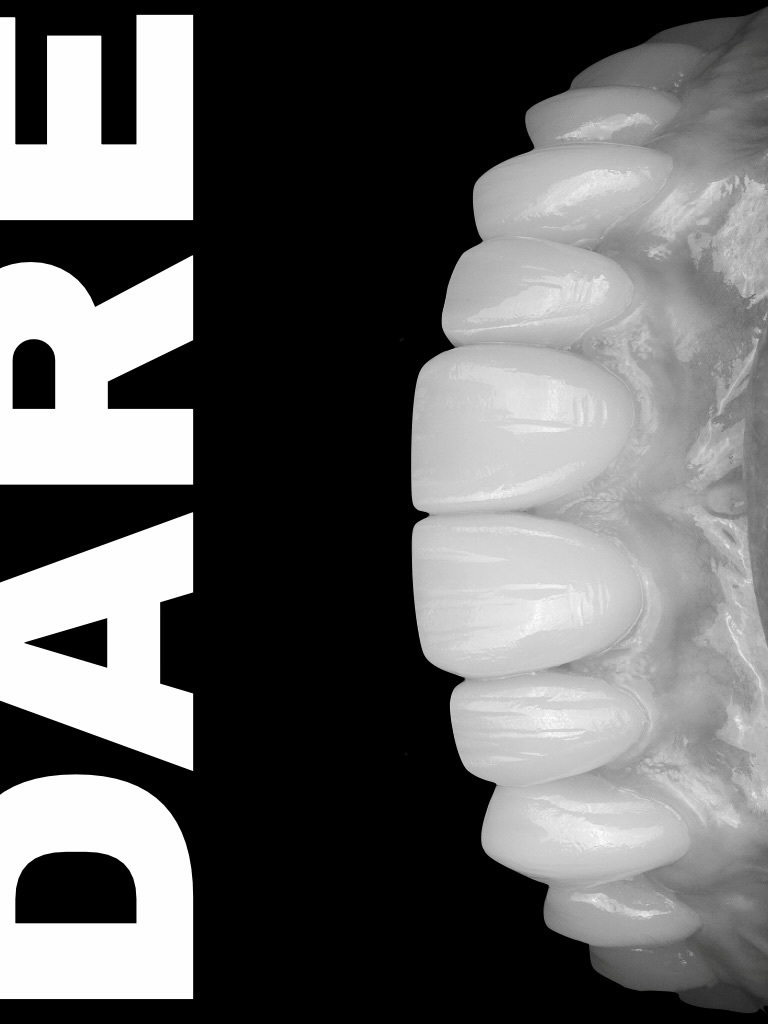 dare